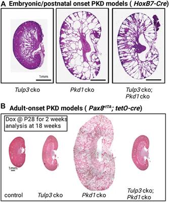 Cilia-Localized Counterregulatory Signals as Drivers of Renal Cystogenesis